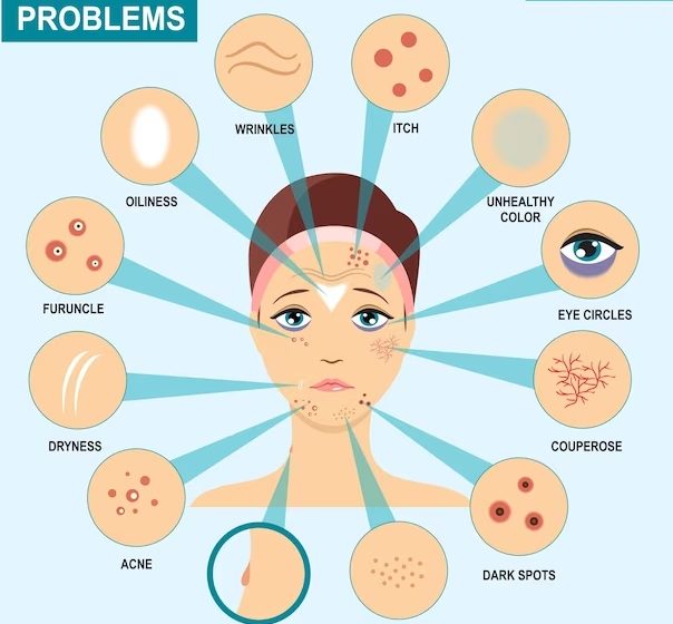 Guide to Understanding Betnovate Cream for Skin Problems