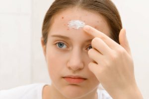 the best acne scar treatment