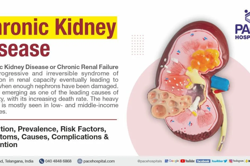 Chronic Kidney Disease